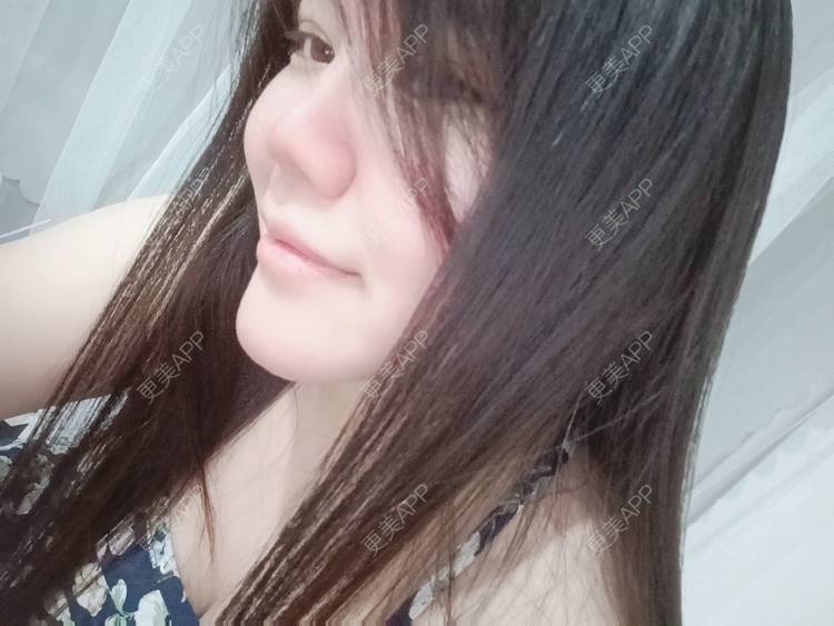 更美 - sonder.的下巴经验 | 下巴 | 硅胶垫下巴 | 长沙 | 视频日记