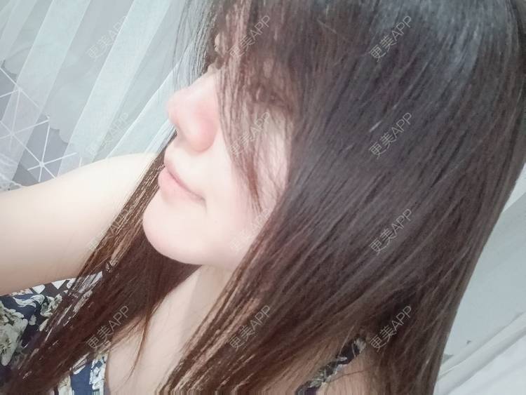 更美 - sonder.的下巴经验 | 下巴 | 硅胶垫下巴 | 长沙 | 视频日记