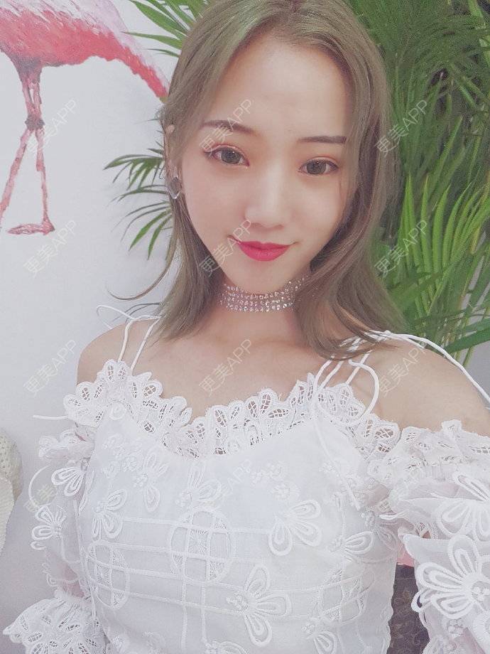 更美 - 氵33的眼部多项经验 | 注射除腋臭 | 眼部多项 | 杭州