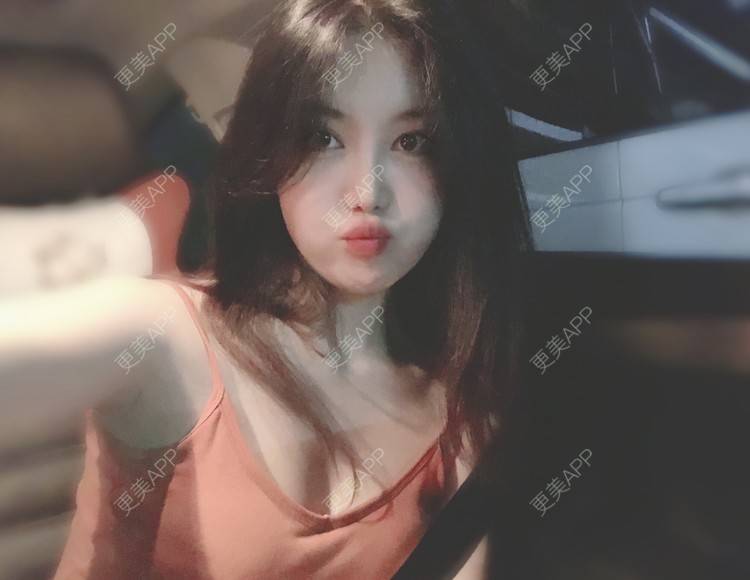 更美 - 兔子la的植发际线经验 | 广州 | 视频日记 | 植发际线