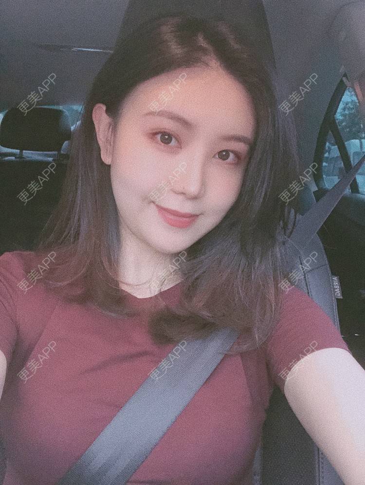 更美 - 兔子la的植发际线经验 | 广州 | 视频日记 | 植发际线