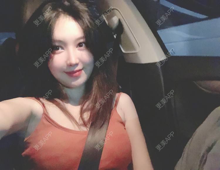 更美 - 兔子la的植发际线经验 | 广州 | 视频日记 | 植发际线