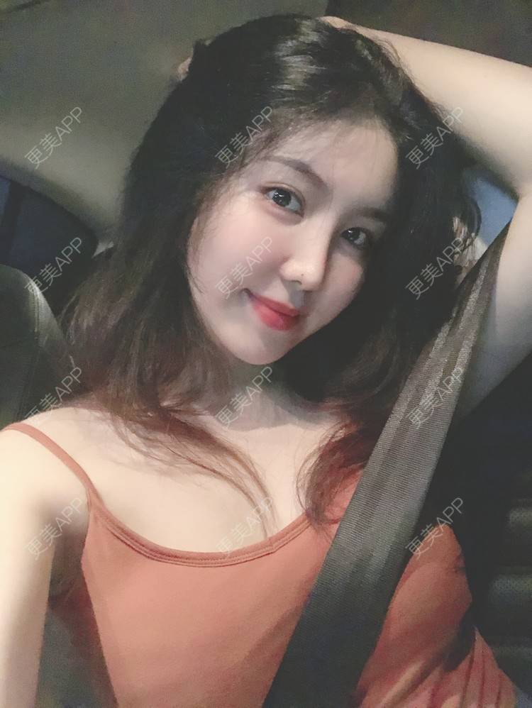 更美 - 兔子la的植发际线经验 | 广州 | 视频日记 | 植发际线