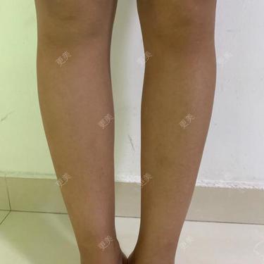 更美用户t8Ut659CxI