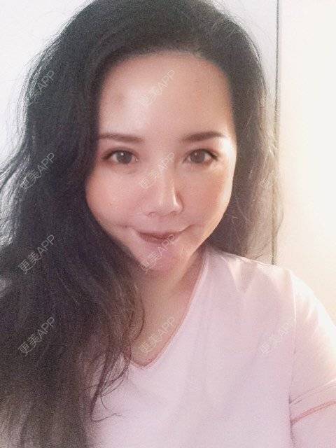 更美 - 更美用户amyZHbrzsl的全瓷牙经验 | 全瓷牙 | 上海