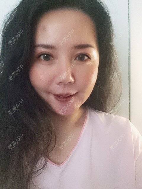 更美 - 更美用户amyZHbrzsl的全瓷牙经验 | 全瓷牙 | 上海