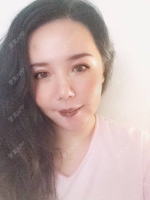 更美 - 更美用户amyZHbrzsl的全瓷牙经验 | 全瓷牙 | 上海