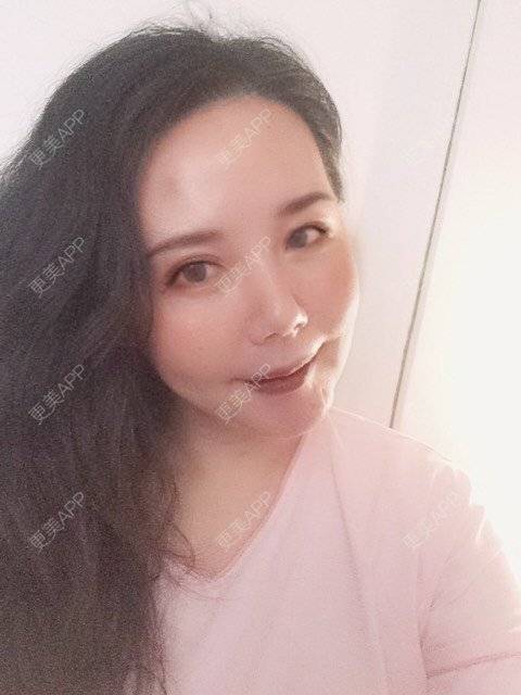 更美 - 更美用户amyZHbrzsl的全瓷牙经验 | 全瓷牙 | 上海