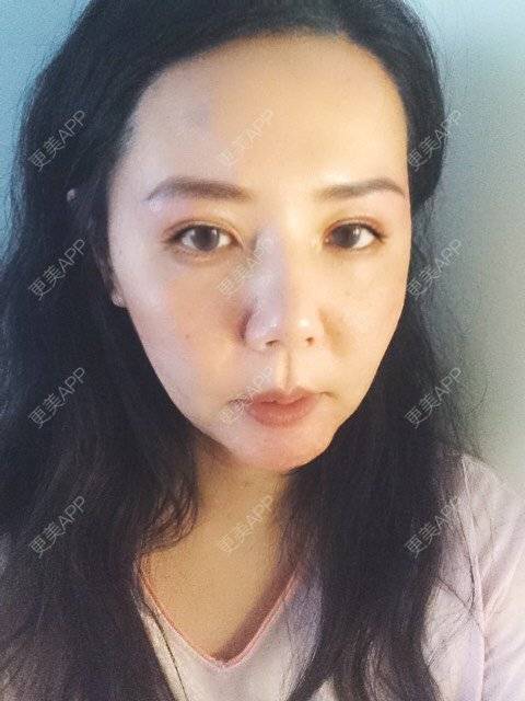 更美 - 更美用户amyZHbrzsl的全瓷牙经验 | 全瓷牙 | 上海