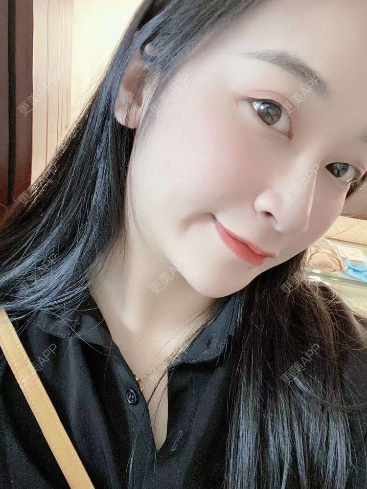 更美 - 更美用户129LF9Yh6a的玻尿酸下巴经验 | 广州 | 视频日记 | 玻尿酸下巴