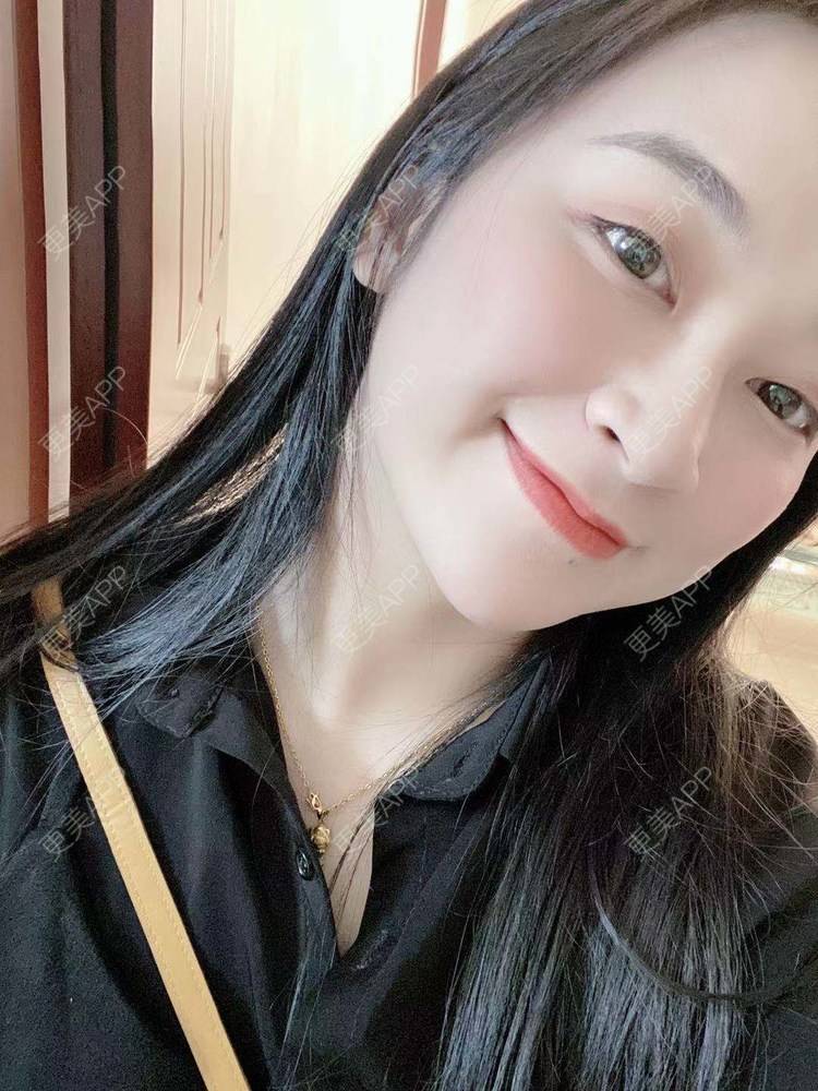 更美 - 更美用户129LF9Yh6a的玻尿酸下巴经验 | 广州 | 视频日记 | 玻尿酸下巴