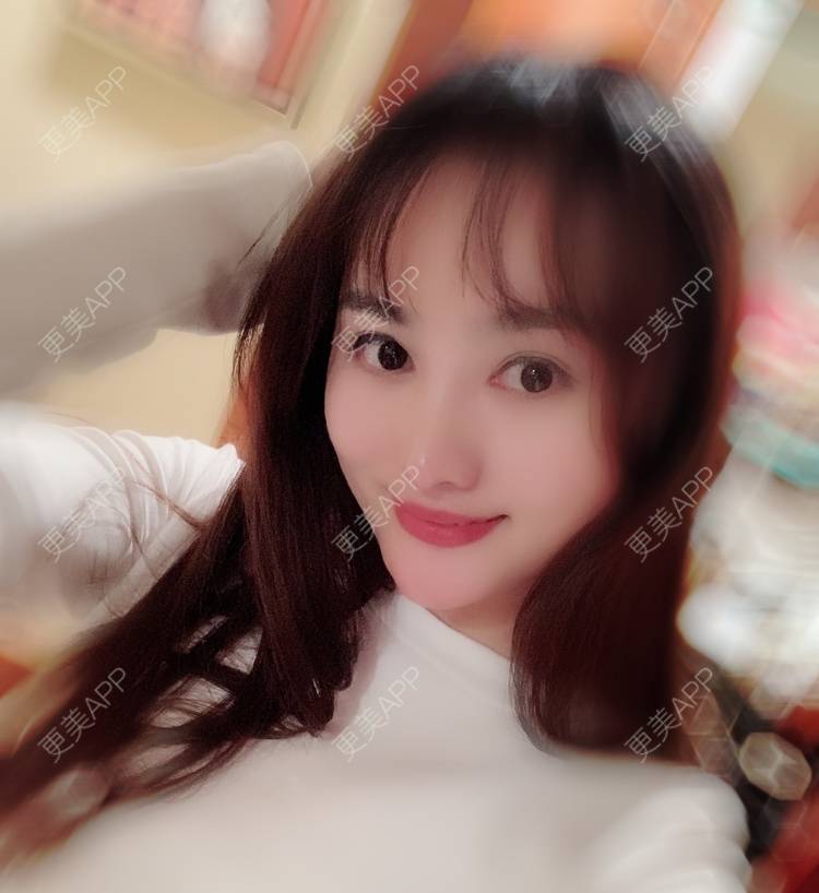 更美 - 更美用户tYzlahBO6T的植发际线经验 | 植发际线 | 深圳 | 毛发移植