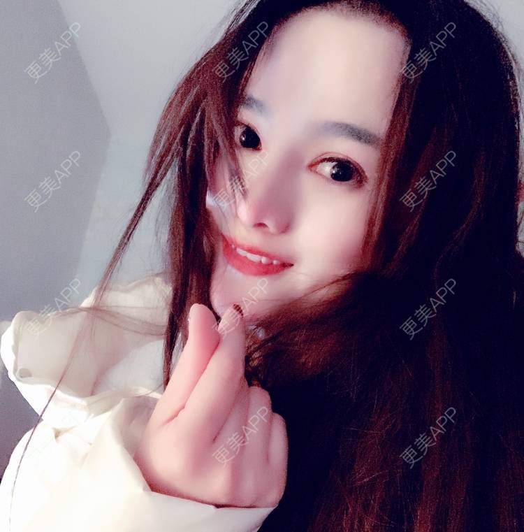 更美 - 更美用户tYzlahBO6T的植发际线经验 | 植发际线 | 深圳 | 毛发移植