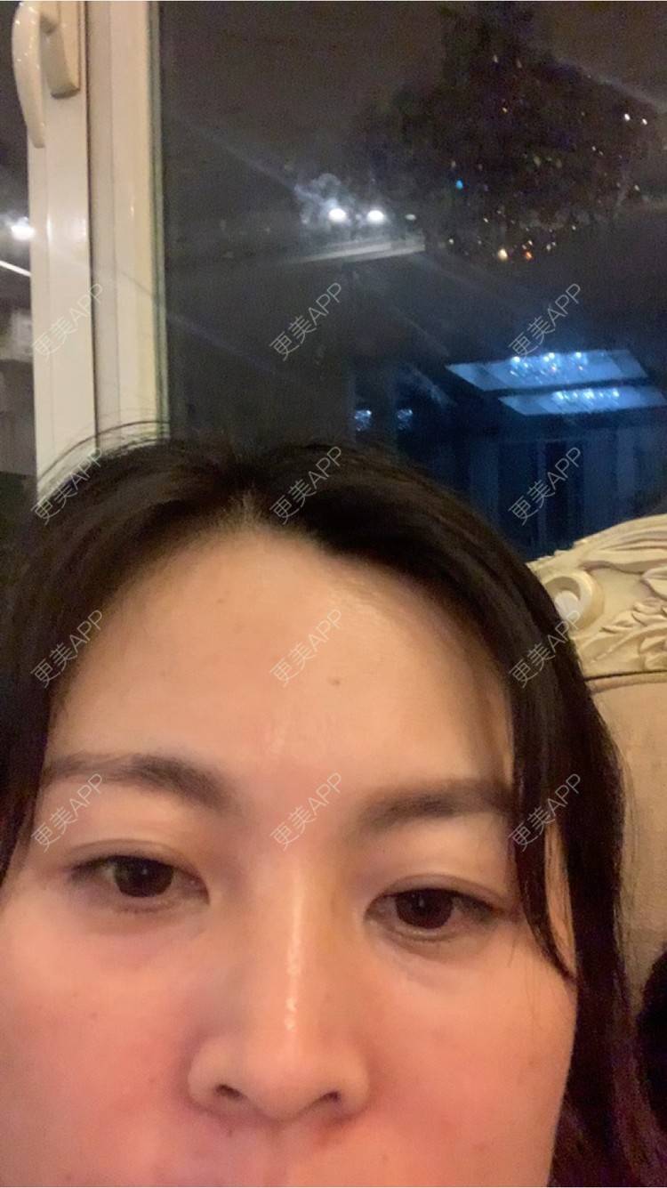 更美 - 更美用户FoNzyYAEYY的半永久纹眼线经验 | 北京 | 半永久纹眼线