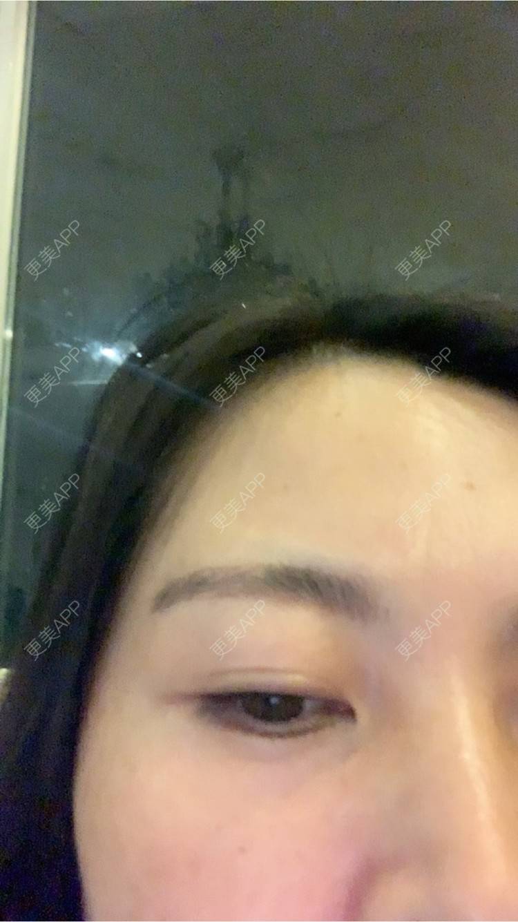 更美 - 更美用户FoNzyYAEYY的半永久纹眼线经验 | 北京 | 半永久纹眼线