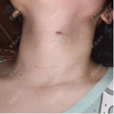 更美 - 胡歌大太太的颈部经验 | 颈部 | 上海