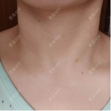 更美 - 胡歌大太太的颈部经验 | 颈部 | 上海