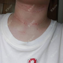 更美 - 胡歌大太太的颈部经验 | 颈部 | 上海