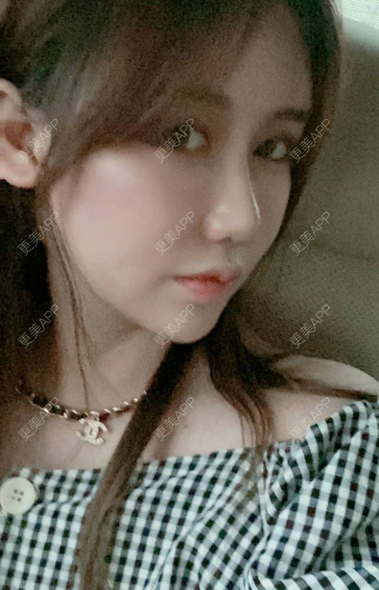 更美 - 佳佳SJ的鼻部多项经验 | 上海 | 视频日记 | 鼻部多项