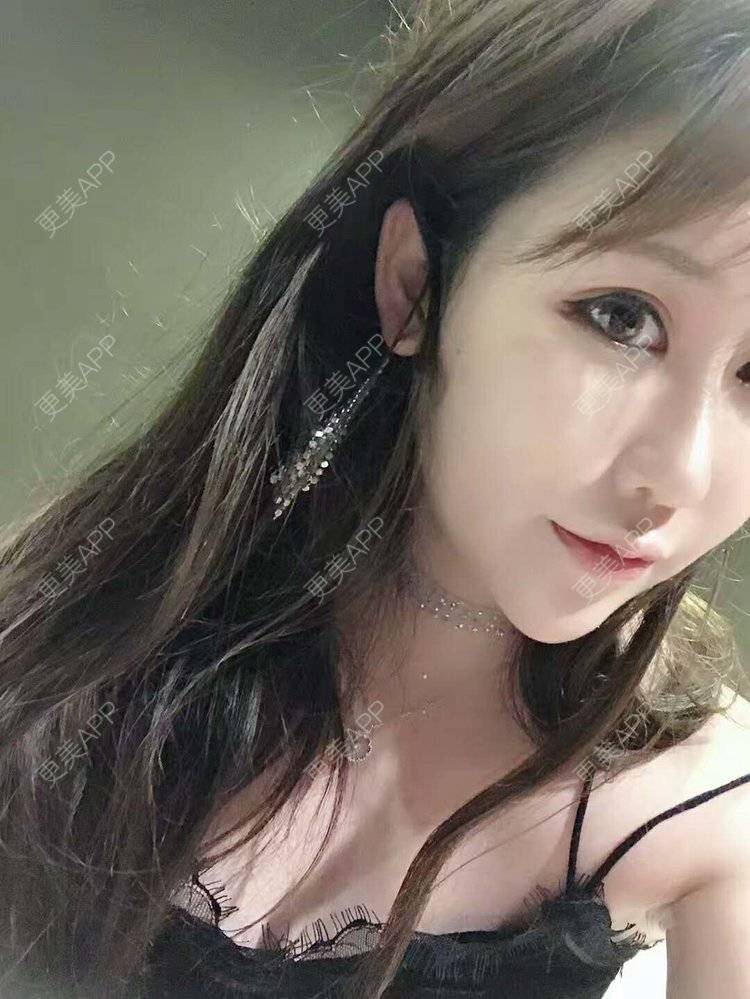 更美 - 佳佳SJ的鼻部多项经验 | 上海 | 视频日记 | 鼻部多项