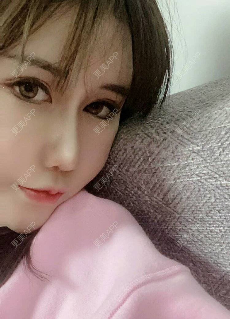 更美 - 佳佳SJ的鼻部多项经验 | 上海 | 视频日记 | 鼻部多项