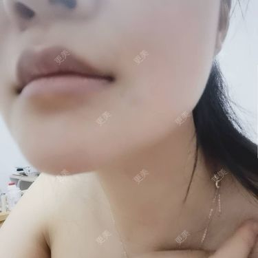 水里的一条鱼