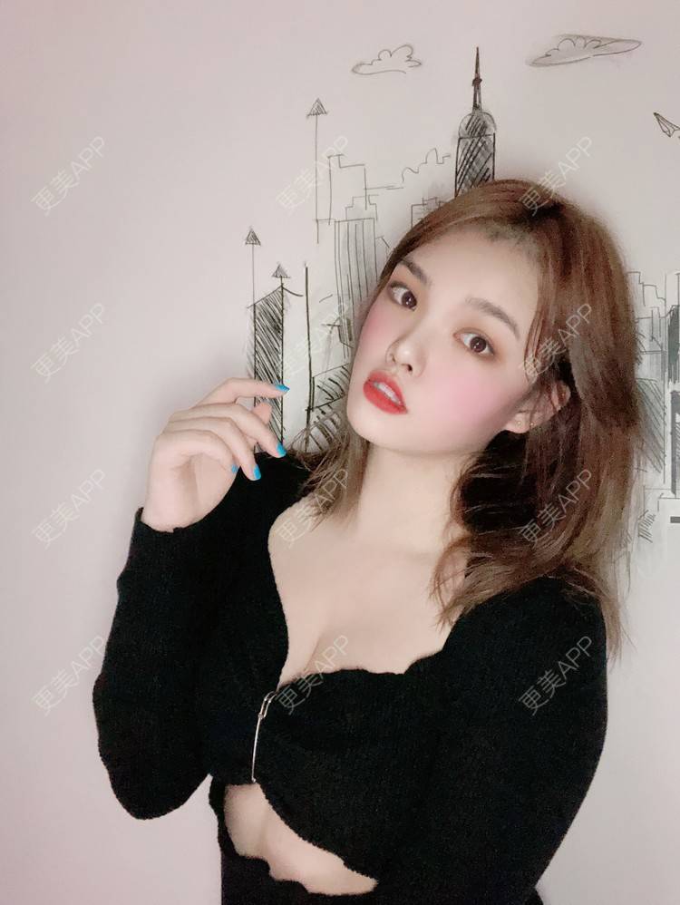 更美 - 更美用户pO1qWVHYOc的假体隆胸经验 | 广州 | 视频日记 | 假体隆胸