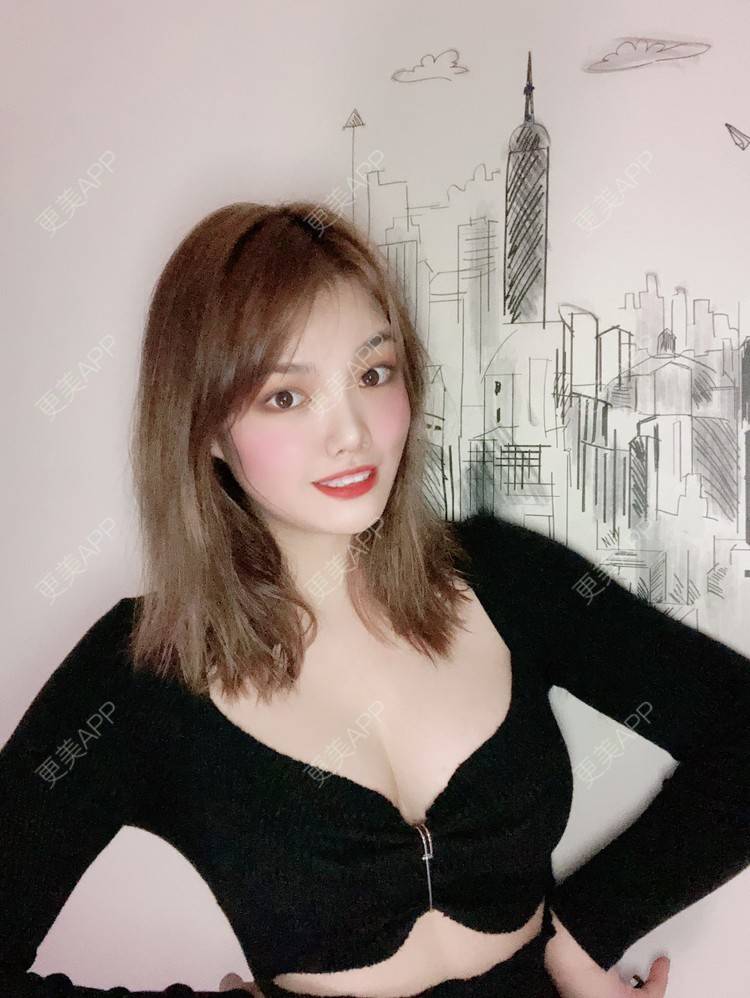 更美 - 更美用户pO1qWVHYOc的假体隆胸经验 | 广州 | 视频日记 | 假体隆胸