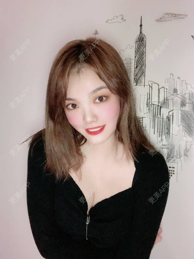 更美 - 更美用户pO1qWVHYOc的假体隆胸经验 | 广州 | 视频日记 | 假体隆胸