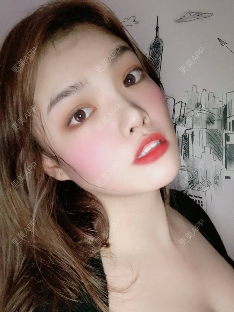 更美 - 更美用户pO1qWVHYOc的假体隆胸经验 | 广州 | 视频日记 | 假体隆胸