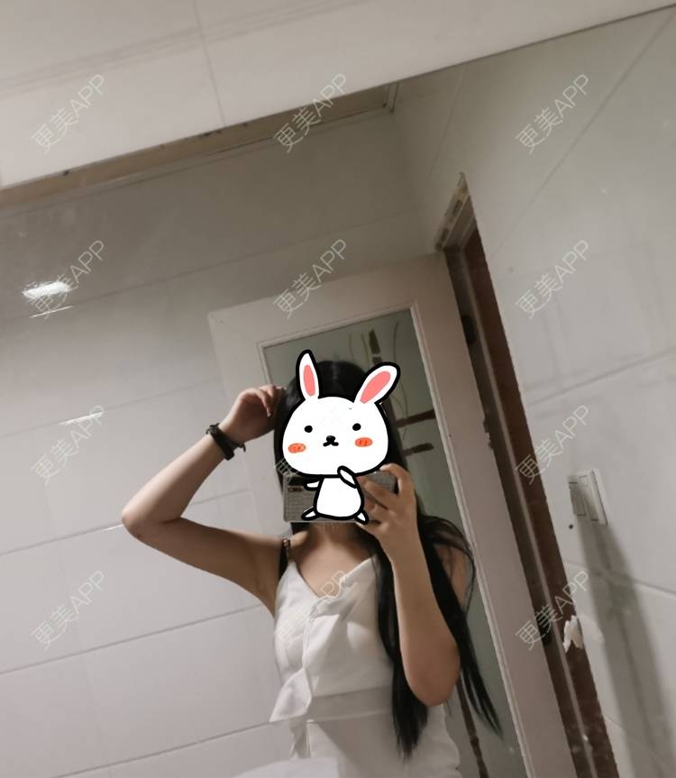 更美 - 更美用户jHjijlJNxV的手臂吸脂经验 | 手臂吸脂 | 广州