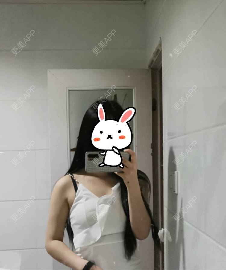 更美 - 更美用户jHjijlJNxV的手臂吸脂经验 | 手臂吸脂 | 广州