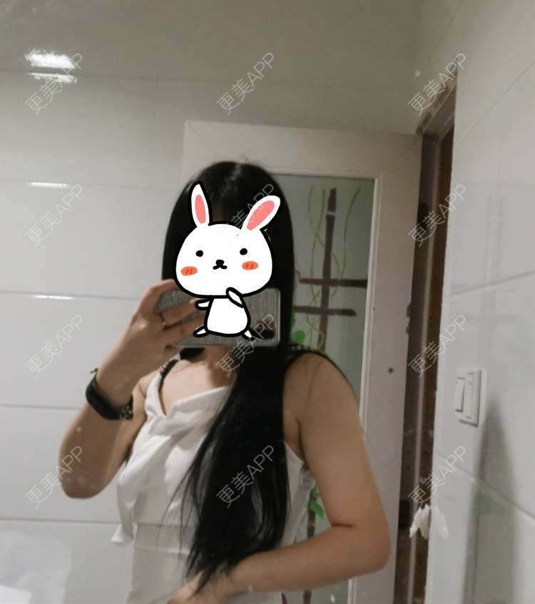 更美 - 更美用户jHjijlJNxV的手臂吸脂经验 | 手臂吸脂 | 广州