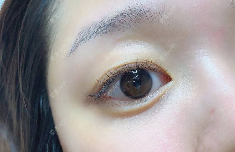 更美 - 更美用户jXjd7AckA8的冷光美白经验 | 冷光美白 | 上海 | 超声波洗牙