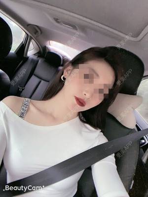 更美 - 看看介绍的自体脂肪丰面颊经验 | 更美研究所 | 自体脂肪全面部填充 | 杭州 | 自体脂肪丰面颊