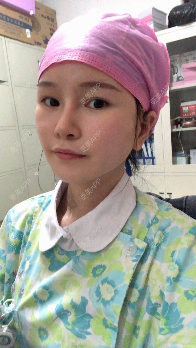 更美 - 更美用户1hOuWDVG0V的下颌角经验 | 成都 | 下颌角