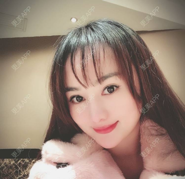 更美 - 更美用户tYzlahBO6T的植发际线经验 | 植发际线 | 深圳 | 毛发移植