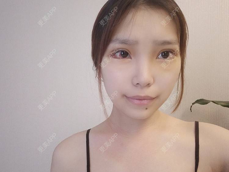 更美用户xkuxa85urw的全切双眼皮日记