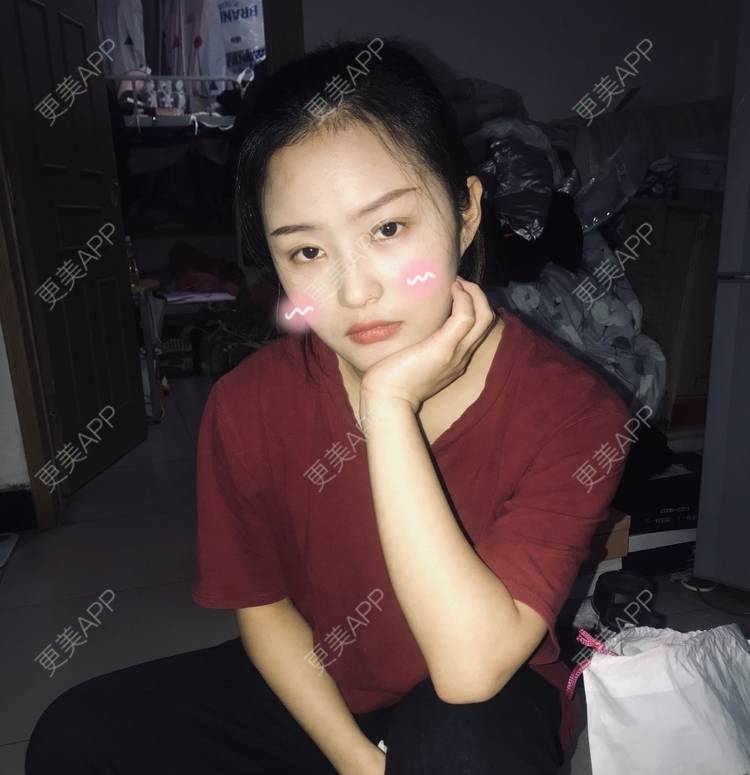 更美 - 更美最美的人的皮秒激光经验 | 皮秒激光 | 小气泡 | 淡斑套餐 | 皮肤综合管理套餐 | 北京