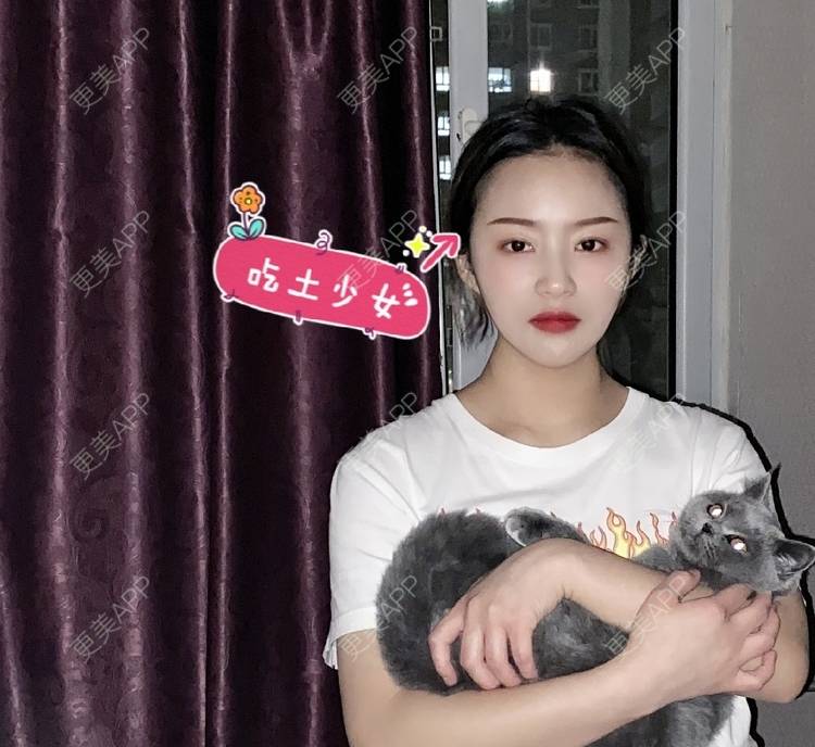 更美 - 更美最美的人的皮秒激光经验 | 皮秒激光 | 小气泡 | 淡斑套餐 | 皮肤综合管理套餐 | 北京