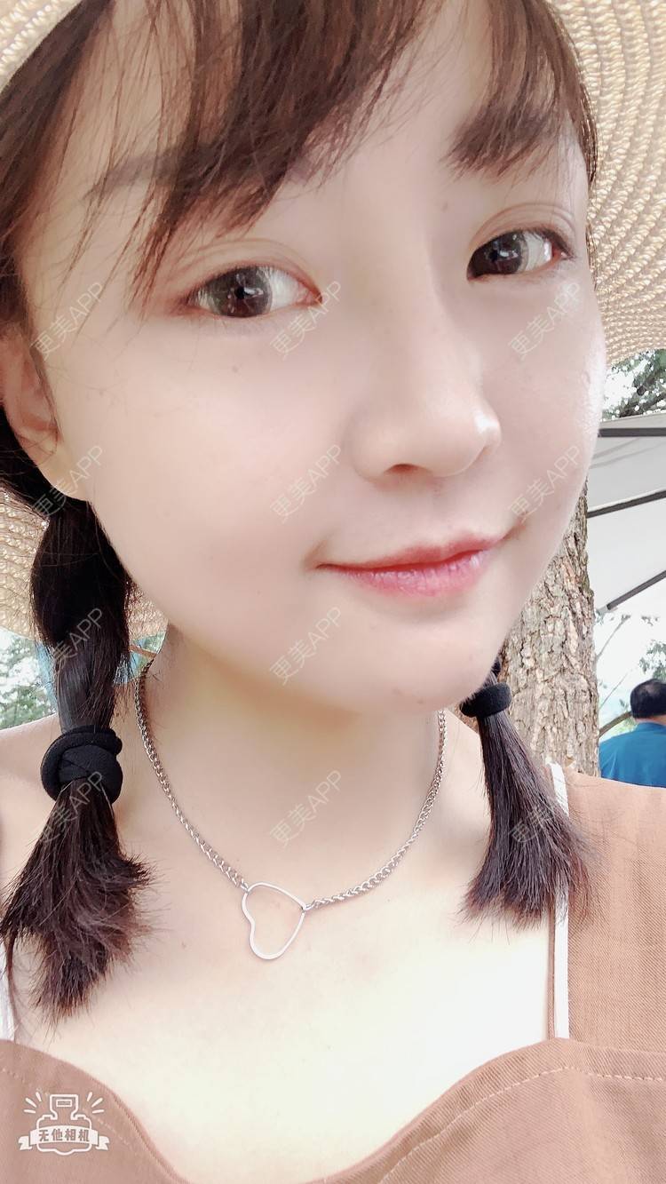 更美 - 🎹清清的除皱瘦脸经验 | 除皱瘦脸 | 昆明