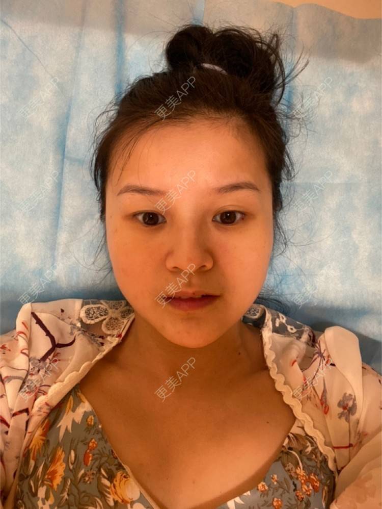 更美 - 一白遮三丑丑丑的热拉提经验 | 上海 | 热拉提