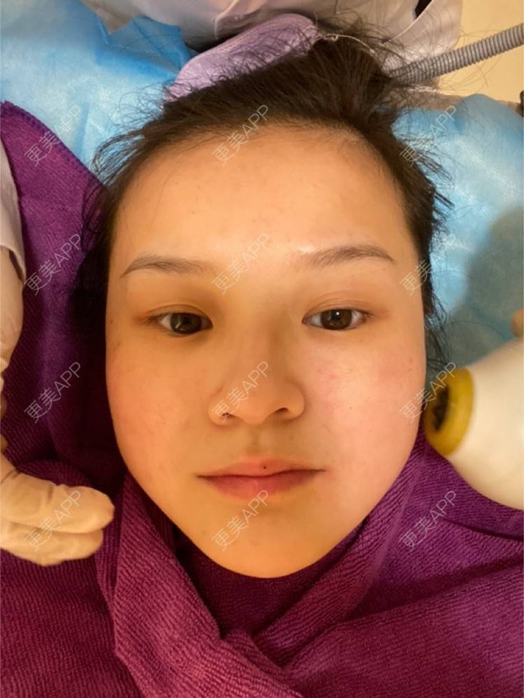 更美 - 一白遮三丑丑丑的热拉提经验 | 上海 | 热拉提