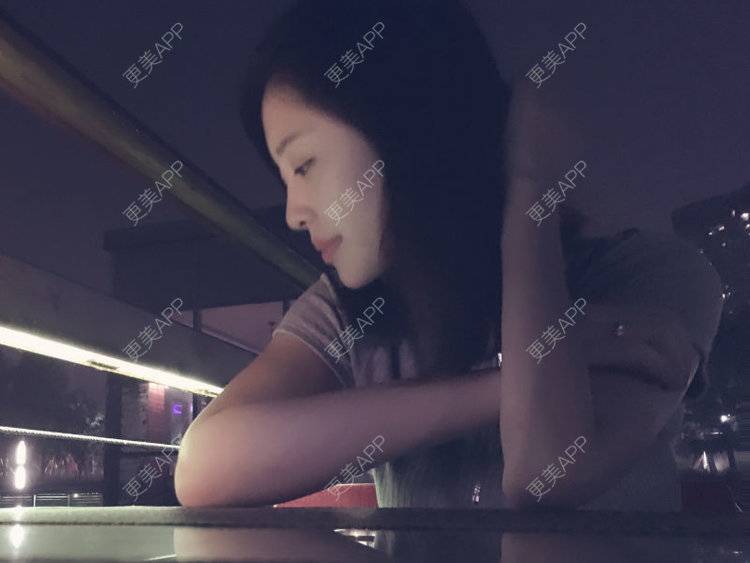 更美 - 更美用户Q7MwbEHUmr的胶原蛋白丰太阳穴经验 | 玻尿酸太阳穴 | 胶原蛋白丰太阳穴 | 深圳
