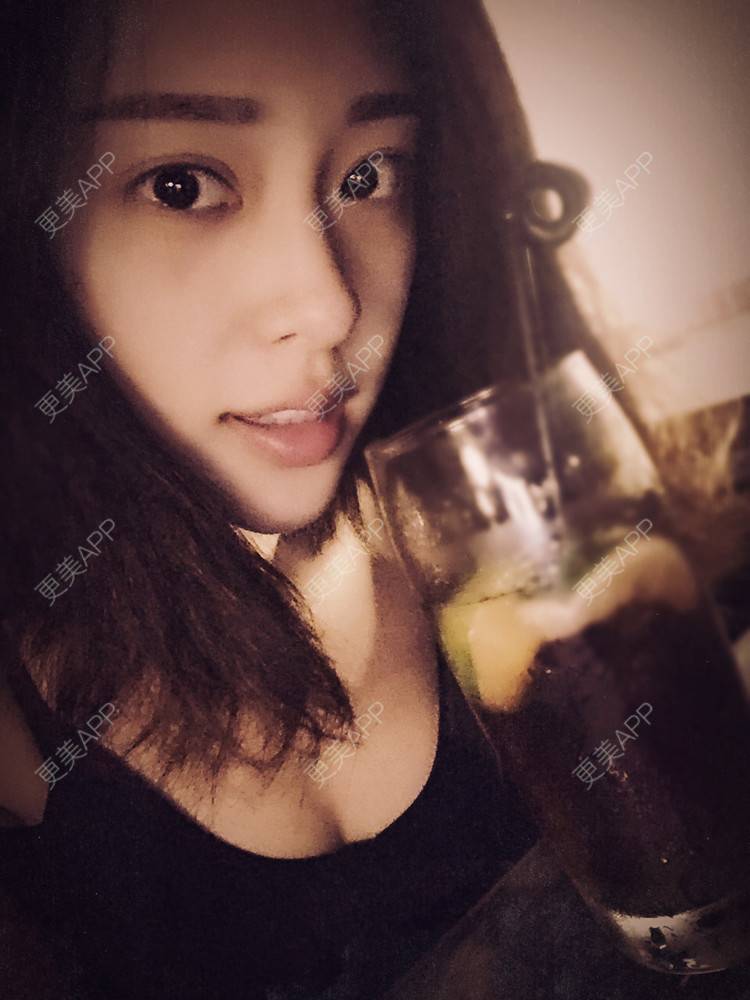 更美 - 更美用户Q7MwbEHUmr的胶原蛋白丰太阳穴经验 | 玻尿酸太阳穴 | 胶原蛋白丰太阳穴 | 深圳