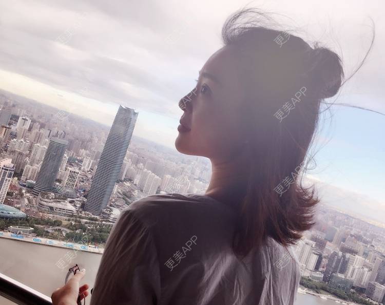 更美 - 更美用户Q7MwbEHUmr的胶原蛋白丰太阳穴经验 | 玻尿酸太阳穴 | 胶原蛋白丰太阳穴 | 深圳