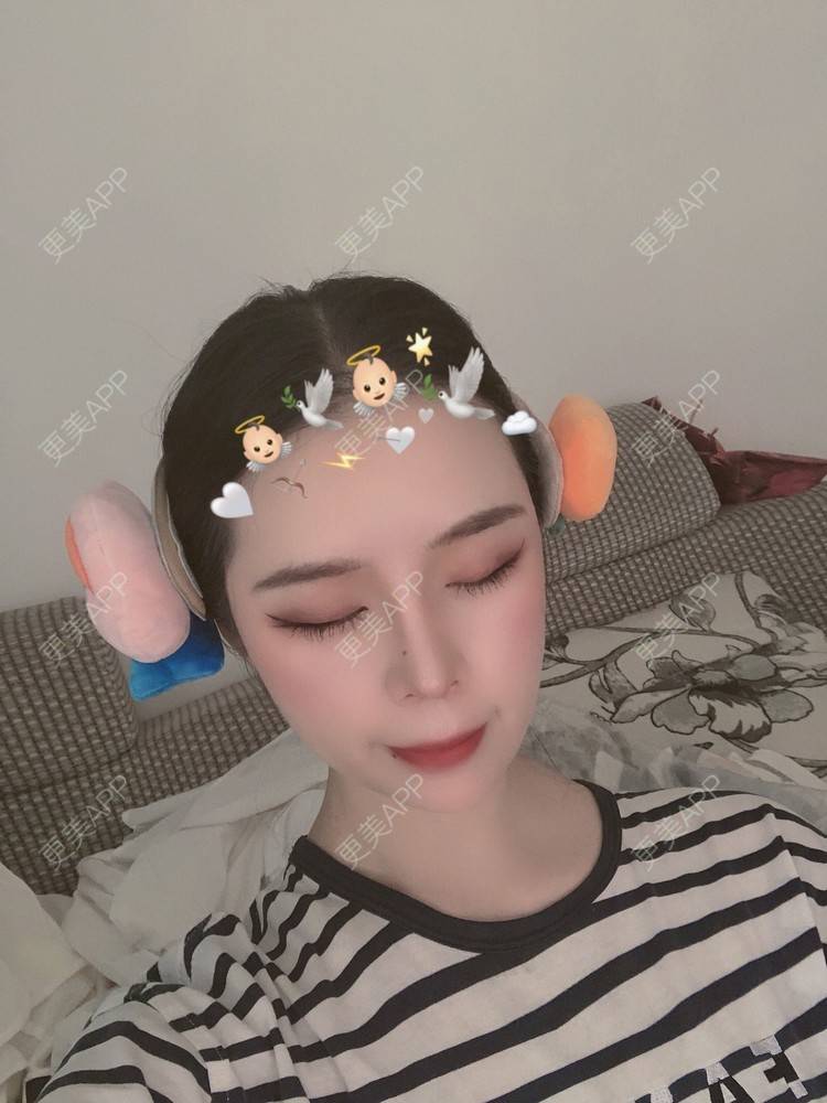 更美 - 超级超级好吃的下巴经验 | 膨体垫下巴 | 宽下巴矫正 | 人工骨垫下巴 | 双下巴溶脂 | 胶原蛋白丰下巴 | 下巴