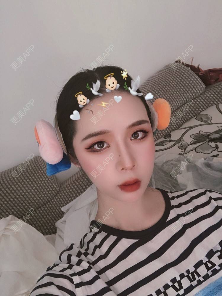 更美 - 超级超级好吃的鼻部多项经验 | 肋软骨隆鼻 | 耳软骨隆鼻 | 鼻中隔软骨隆鼻 | 自体肋软骨垫鼻基底 | 自体软骨垫鼻尖 | 鼻部多项 | 手术缩鼻头 | 鼻中隔软骨垫鼻头 | 注射缩鼻头 | 鼻小柱缩短