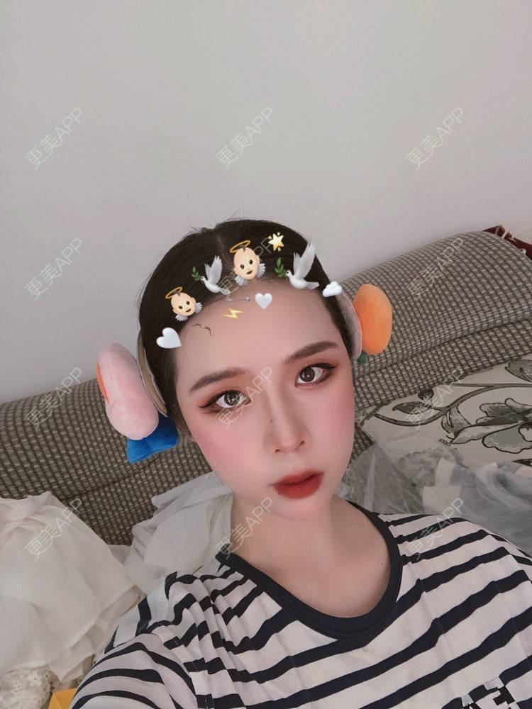 更美 - 超级超级好吃的鼻部多项经验 | 肋软骨隆鼻 | 耳软骨隆鼻 | 鼻中隔软骨隆鼻 | 自体肋软骨垫鼻基底 | 自体软骨垫鼻尖 | 鼻部多项 | 手术缩鼻头 | 鼻中隔软骨垫鼻头 | 注射缩鼻头 | 鼻小柱缩短