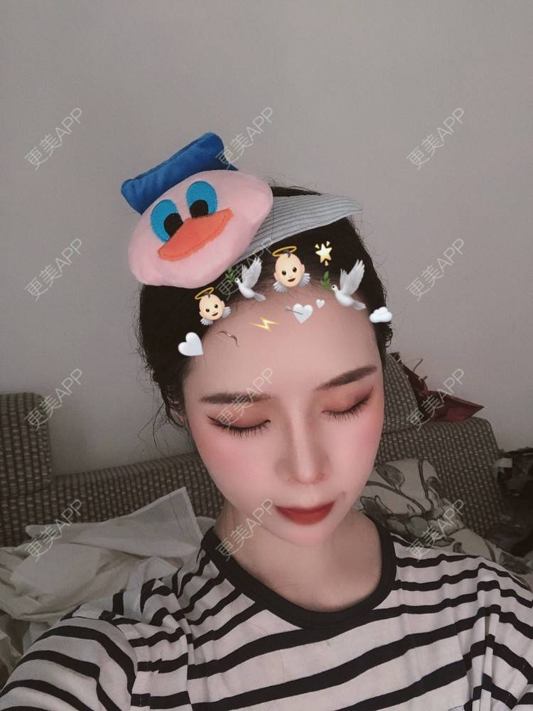 更美 - 超级超级好吃的鼻部多项经验 | 肋软骨隆鼻 | 耳软骨隆鼻 | 鼻中隔软骨隆鼻 | 自体肋软骨垫鼻基底 | 自体软骨垫鼻尖 | 鼻部多项 | 手术缩鼻头 | 鼻中隔软骨垫鼻头 | 注射缩鼻头 | 鼻小柱缩短